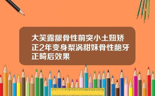 大笑露龈骨性前突小土妞矫正2年变身梨涡甜妹骨性龅牙正畸后效果