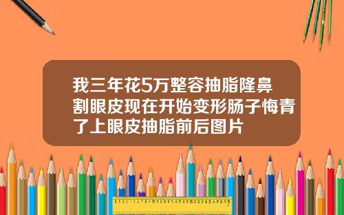 我三年花5万整容抽脂隆鼻割眼皮现在开始变形肠子悔青了上眼皮抽脂前后图片