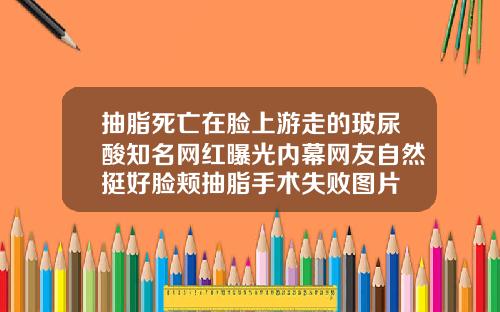 抽脂死亡在脸上游走的玻尿酸知名网红曝光内幕网友自然挺好脸颊抽脂手术失败图片