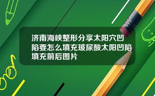 济南海峡整形分享太阳穴凹陷要怎么填充玻尿酸太阳凹陷填充前后图片