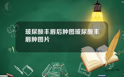 玻尿酸丰唇后肿图玻尿酸丰唇肿图片