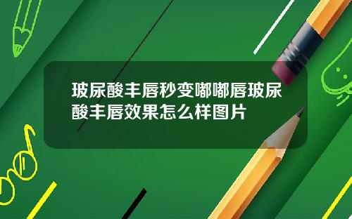 玻尿酸丰唇秒变嘟嘟唇玻尿酸丰唇效果怎么样图片