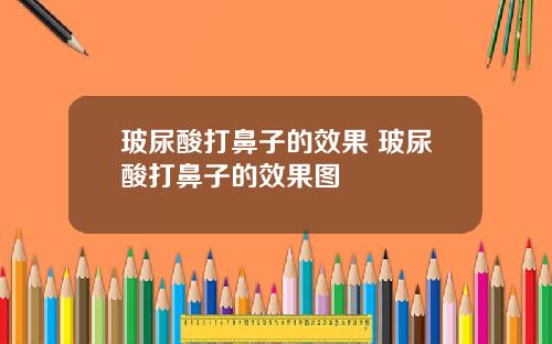 玻尿酸打鼻子的效果 玻尿酸打鼻子的效果图