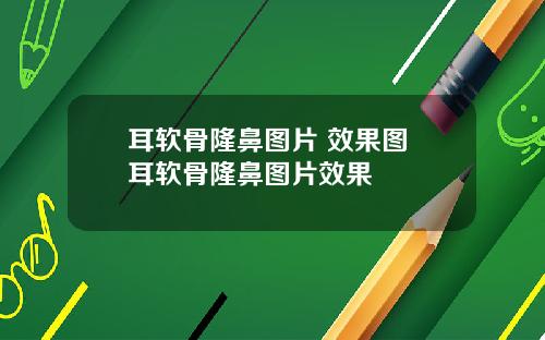 耳软骨隆鼻图片 效果图 耳软骨隆鼻图片效果