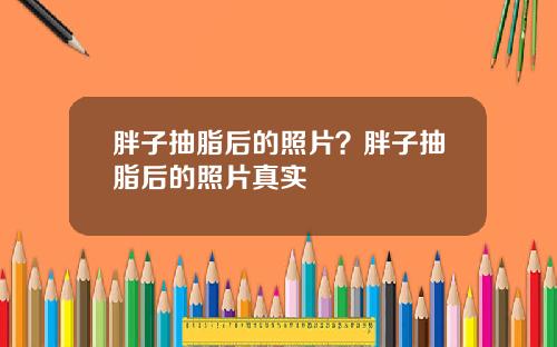 胖子抽脂后的照片？胖子抽脂后的照片真实
