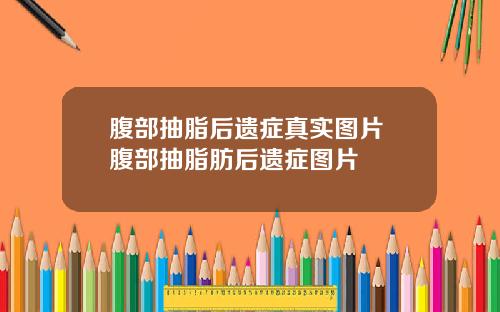 腹部抽脂后遗症真实图片 腹部抽脂肪后遗症图片