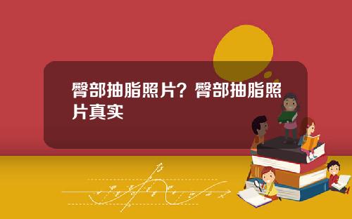 臀部抽脂照片？臀部抽脂照片真实