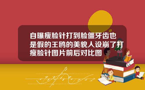 自曝瘦脸针打到脸僵牙齿也是假的王鸥的美貌人设崩了打瘦脸针图片前后对比图