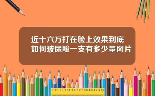 近十六万打在脸上效果到底如何玻尿酸一支有多少量图片