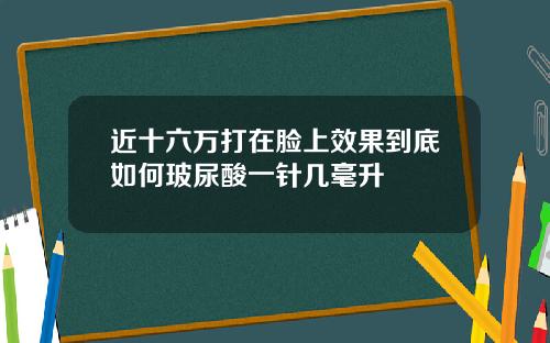 近十六万打在脸上效果到底如何玻尿酸一针几毫升