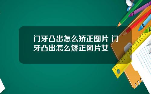 门牙凸出怎么矫正图片 门牙凸出怎么矫正图片女