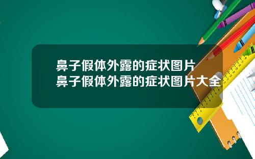 鼻子假体外露的症状图片 鼻子假体外露的症状图片大全