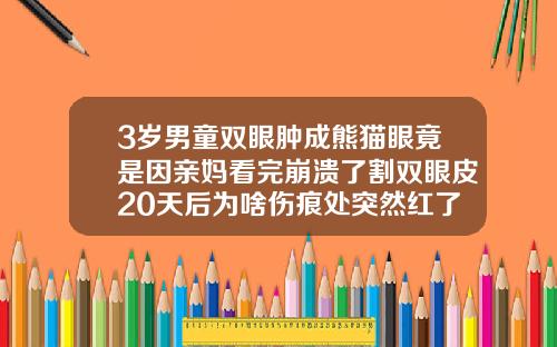 3岁男童双眼肿成熊猫眼竟是因亲妈看完崩溃了割双眼皮20天后为啥伤痕处突然红了