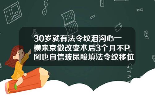 30岁就有法令纹泪沟心一横来京做改变术后3个月不P图也自信玻尿酸填法令纹移位
