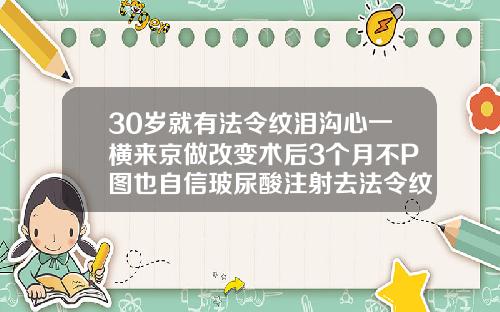 30岁就有法令纹泪沟心一横来京做改变术后3个月不P图也自信玻尿酸注射去法令纹价格