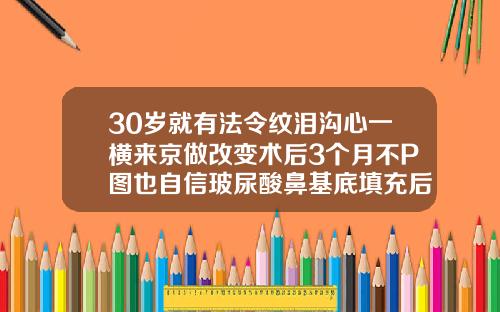 30岁就有法令纹泪沟心一横来京做改变术后3个月不P图也自信玻尿酸鼻基底填充后注意事项