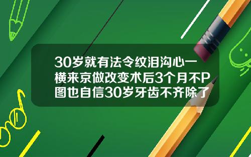 30岁就有法令纹泪沟心一横来京做改变术后3个月不P图也自信30岁牙齿不齐除了矫正还有什么办法改善