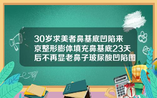 30岁求美者鼻基底凹陷来京整形膨体填充鼻基底23天后不再显老鼻子玻尿酸凹陷图片
