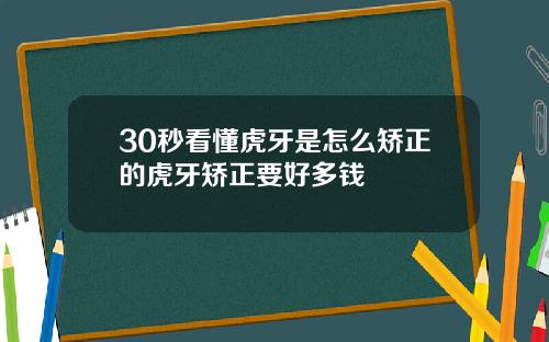 30秒看懂虎牙是怎么矫正的虎牙矫正要好多钱