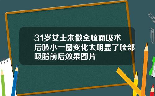 31岁女士来做全脸面吸术后脸小一圈变化太明显了脸部吸脂前后效果图片