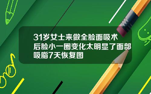 31岁女士来做全脸面吸术后脸小一圈变化太明显了面部吸脂7天恢复图