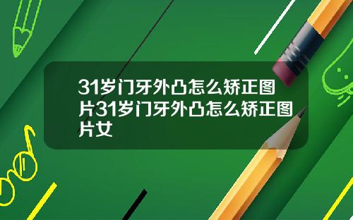 31岁门牙外凸怎么矫正图片31岁门牙外凸怎么矫正图片女