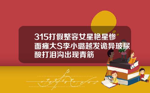 315打假整容女星艳星惨面瘫大S李小璐越发诡异玻尿酸打泪沟出现青筋