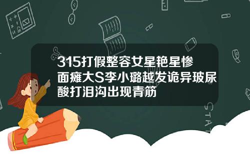 315打假整容女星艳星惨面瘫大S李小璐越发诡异玻尿酸打泪沟出现青筋