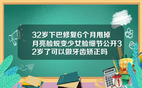 32岁下巴修复6个月甩掉月亮脸蜕变少女脸细节公开32岁了可以做牙齿矫正吗