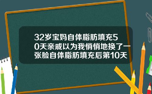 32岁宝妈自体脂肪填充50天亲戚以为我悄悄地换了一张脸自体脂肪填充后第10天还疼