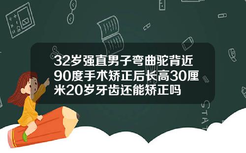 32岁强直男子弯曲驼背近90度手术矫正后长高30厘米20岁牙齿还能矫正吗