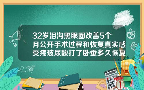 32岁泪沟黑眼圈改善5个月公开手术过程和恢复真实感受疼玻尿酸打了卧蚕多久恢复自然一点