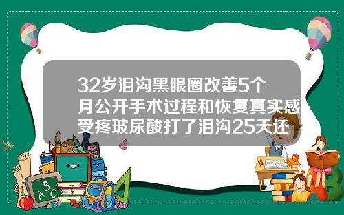 32岁泪沟黑眼圈改善5个月公开手术过程和恢复真实感受疼玻尿酸打了泪沟25天还肿