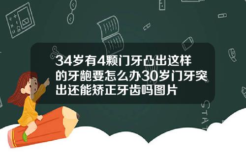 34岁有4颗门牙凸出这样的牙龅要怎么办30岁门牙突出还能矫正牙齿吗图片