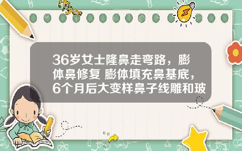 36岁女士隆鼻走弯路，膨体鼻修复+膨体填充鼻基底，6个月后大变样鼻子线雕和玻尿酸哪个持久一点