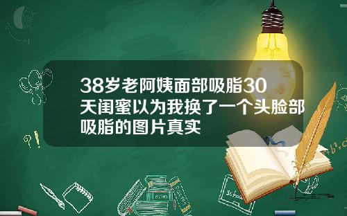 38岁老阿姨面部吸脂30天闺蜜以为我换了一个头脸部吸脂的图片真实