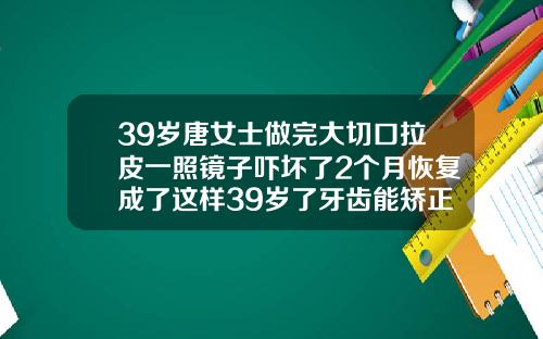 39岁唐女士做完大切口拉皮一照镜子吓坏了2个月恢复成了这样39岁了牙齿能矫正吗视频