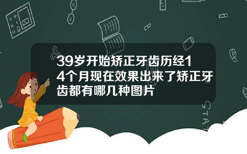 39岁开始矫正牙齿历经14个月现在效果出来了矫正牙齿都有哪几种图片