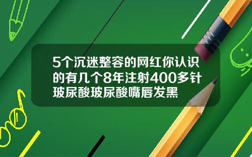 5个沉迷整容的网红你认识的有几个8年注射400多针玻尿酸玻尿酸嘴唇发黑