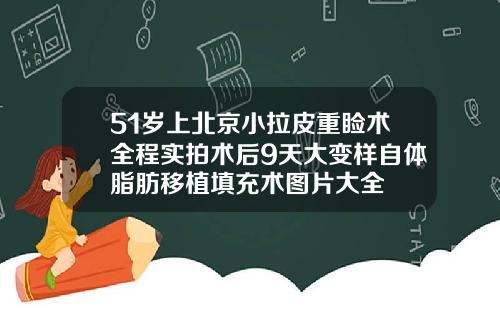 51岁上北京小拉皮重睑术全程实拍术后9天大变样自体脂肪移植填充术图片大全