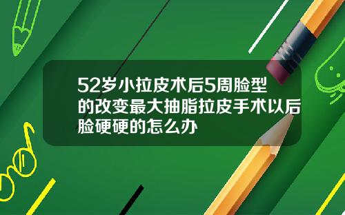 52岁小拉皮术后5周脸型的改变最大抽脂拉皮手术以后脸硬硬的怎么办