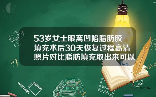 53岁女士眼窝凹陷脂肪胶填充术后30天恢复过程高清照片对比脂肪填充取出来可以恢复以前的样子吗
