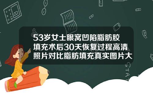 53岁女士眼窝凹陷脂肪胶填充术后30天恢复过程高清照片对比脂肪填充真实图片大全