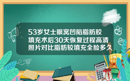 53岁女士眼窝凹陷脂肪胶填充术后30天恢复过程高清照片对比脂肪较填充全脸多久脂肪稳定